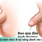 hẹp bao quy đầu ở trẻ em như thế nào chữa trị ra sao