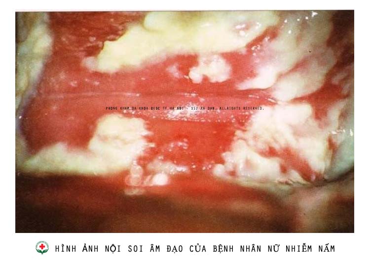 nam-am-dao