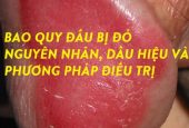 Bao quy đầu bị đỏ: Nguyên nhân, cách điều trị và biện pháp phòng ngừa hiệu quả